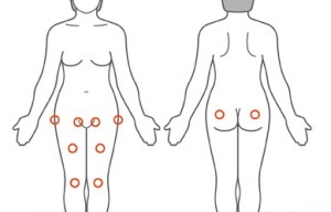 Possible locations of hip pain