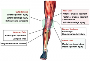 Knee Problems – Natural Results Chiropractic