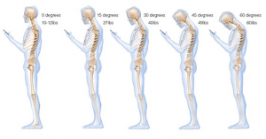 natural-results-posture-texting