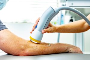 SoftWave Therapy non-invasive treatment for chronic pain